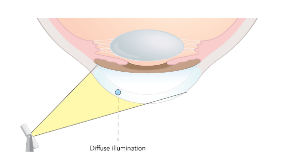 Components and Design of the Slit Lamp